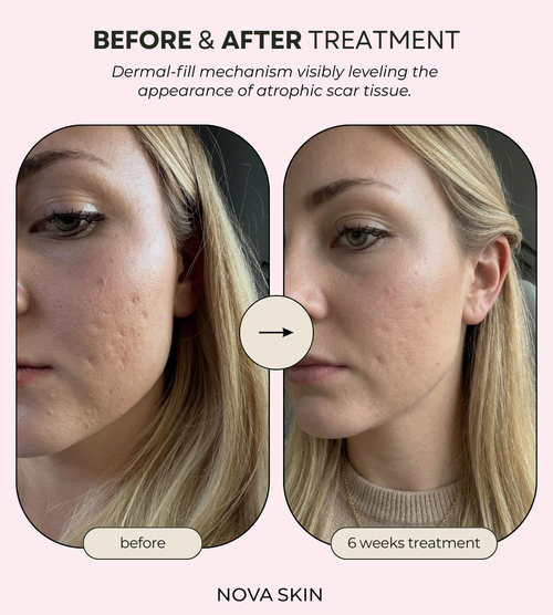 PDRN™ Texture-Blur & Dermal-Fill Serum